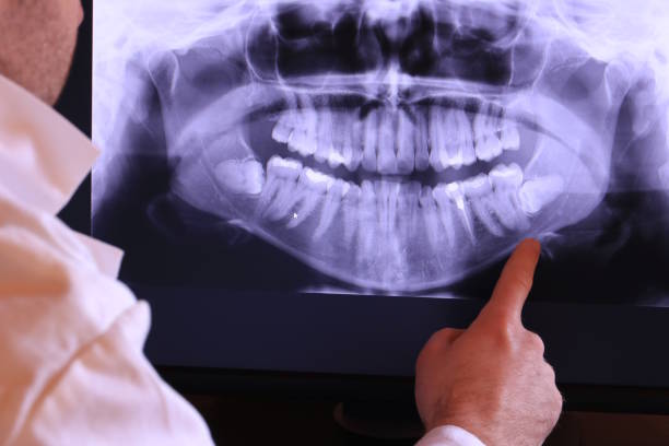 Best Emergency TMJ Treatment in Ball Pond, CT