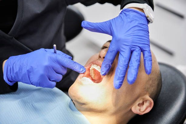 Best Urgent Care for Lost Fillings or Crowns in Ball Pond, CT